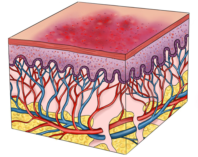 isap 1 fig 9.png