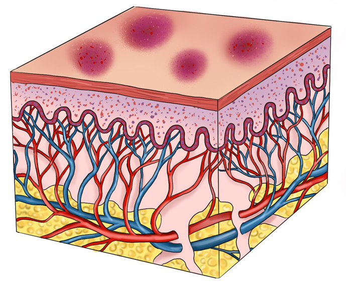 isap 1 fig 7.png